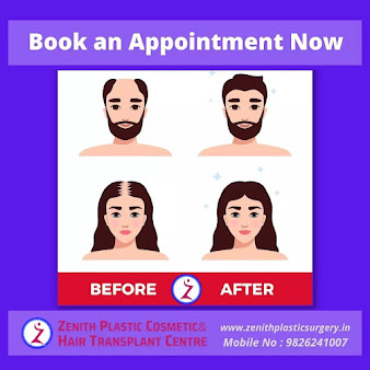 Rhinoplasty Bangalore - Rhinoplasty Bangalore
