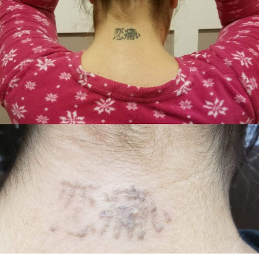 Explore tattoo ideas lotus flower, creative tattoo ideas in Idaho Falls, available at Senza Skin Spa Senza Weight Loss