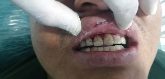 Odontología estética y rehabilitación dental - Dentista