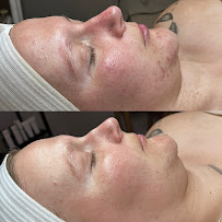 Luna Skin - Photo 5 - Car repair in Temecula, CA, Temecula