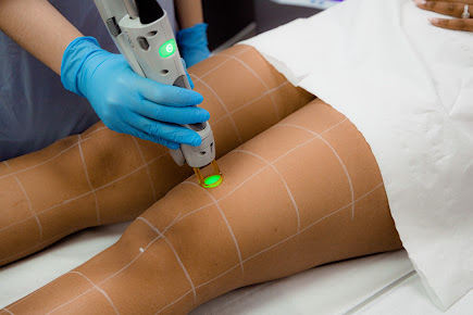 مدينة إزالة الشعر لندن - City Hair Removal London
