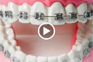 Illuminating Smiles - Dental Clinic & Implant Center | Best Dentist in Pimple Saudagar & Rahatani image