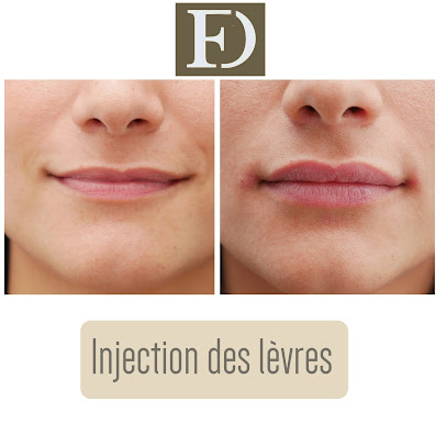 Dr. Franck Ouakil - Dr. Franck Ouakil