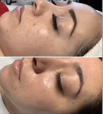 Soft Esthetics - Photo 4 - Car repair in Rancho Cucamonga, CA, Rancho Cucamonga