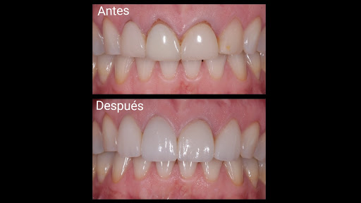 DR. ALEX - Implantes Dentales by DENTAL SV