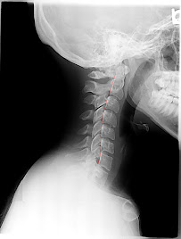 Fiorini Chiropractic Center, P.A.: Tallahassee Auto Accident Injury Physician - Photo 7 - Car repair in Tallahassee, FL, Tallahassee