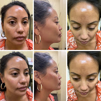 Serenity MD Weight Loss & Medical Spa - Photo 9 - Car repair in Chino, CA, Ontario