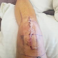 Atlantic Orthopaedic Specialists - Virginia Beach - Photo 2 - Car repair in Virginia Beach, VA, Virginia Beach