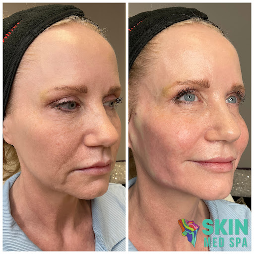 Find tattoo ideas for mother for your next unique tattoo in Downers Grove at Skin Med Spa