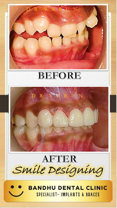 Bandhu Dental Clinic - Bandhu Dental Clinic