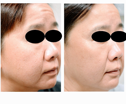 Explore singing tattoo ideas, creative tattoo ideas in Chino, available at SoCal Body Institute