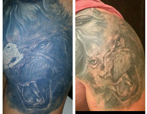 Explore garden tattoo ideas, creative tattoo ideas in Louisville, available at Removery Tattoo Removal & Fading