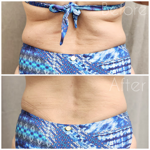 Explore wrist scar tattoo ideas, creative tattoo ideas in Arlington, available at Haven Studio Co. (formerly Ink Haven Studio)