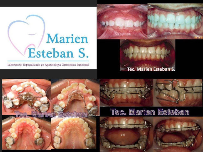 Marien Esteban S. Laboratorio de Ortodoncia - Quito
