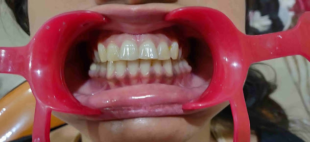 Total Dental Solutions - Total Dental Solutions