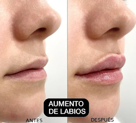 SurgeryinPeru - SurgeryinPeru