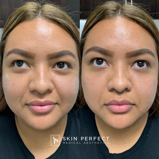 Explore male inner bicep tattoo ideas, creative tattoo ideas in Whittier, available at Skin Perfect Medical Aesthetics