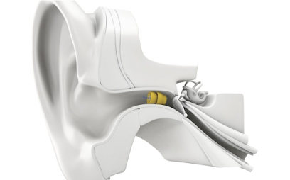 Physician's Choice Hearing Solutions
