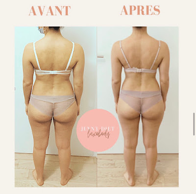 Jenny Azran - Diététicienne Nutritionniste - Luxopuncture à Boulogne-Billancourt
