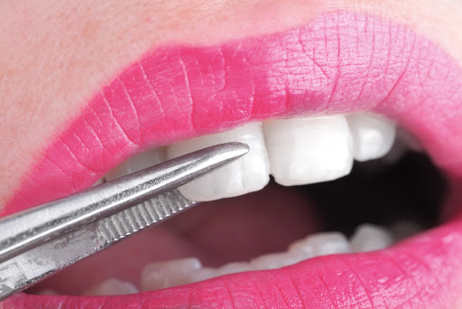 Clínica Dental Tarancón - Implantostetic en Tarancón, Cuenca