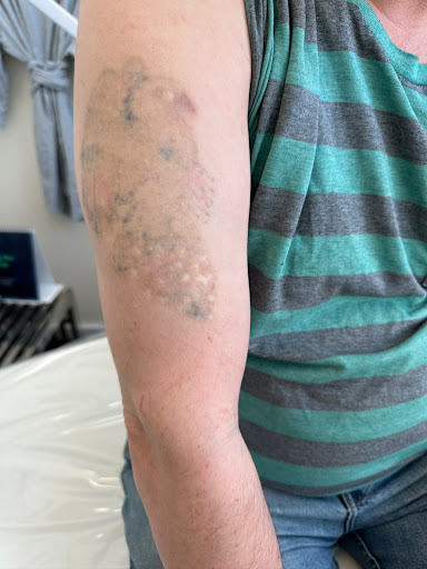 Explore nf tattoo ideas, creative tattoo ideas in Bayside, available at Laser Goddess