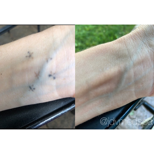 Explore collar tattoo ideas, creative tattoo ideas in Canton, available at JDV Med Spa