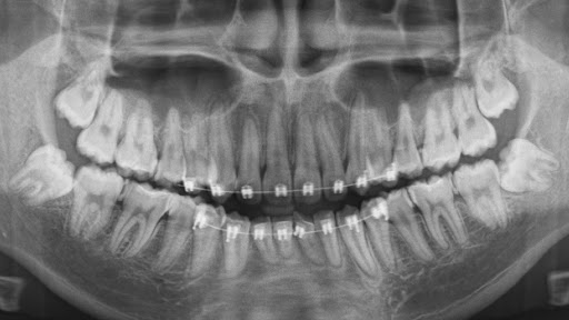 McKee Dental X-Ray