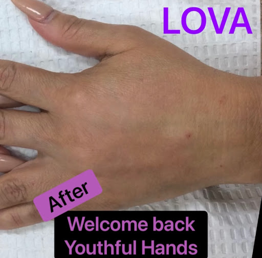 Explore grandmother tattoo ideas, creative tattoo ideas in Lake Oswego, available at Lake Oswego Vein and Aesthetic LOVA