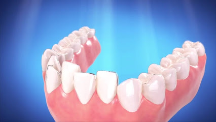 Taylor Street Dental: No.1 state-of-the-art Invisalign® | Cosmetic Dentist