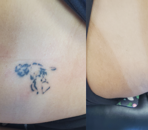 Explore group tattoo ideas for 5, creative tattoo ideas in Rochester, available at Rochester Tattoo Removal