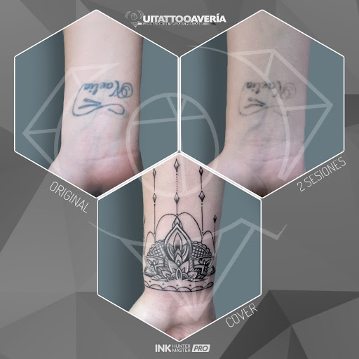 Eliminación de Tatuajes Isla Cristina - QUITATTOOAVERIA