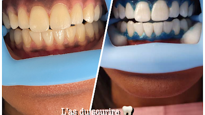 L'as du sourire à Gagny