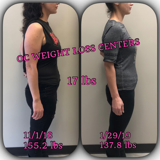 OC Weight Loss Centers & CoolSculpting image