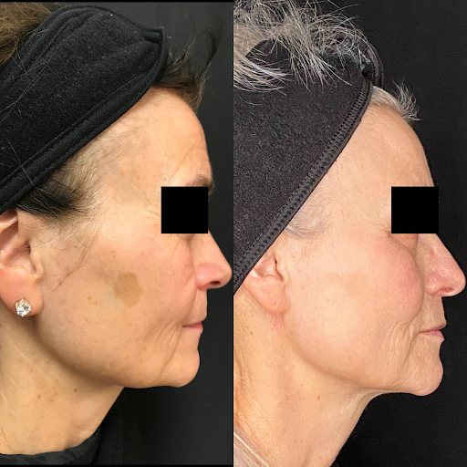 Explore ice nine kills tattoo ideas, creative tattoo ideas in Brookfield, available at Milwaukee Laser & Body Aesthetics