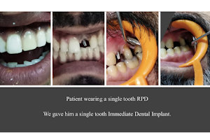 iDental | Best Dentist in Greater Noida image