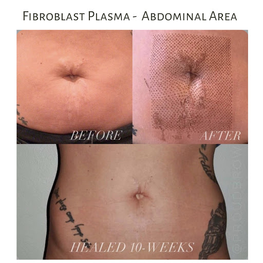 Explore rib tattoo ideas for women, creative tattoo ideas in Lewiston, available at Permanent Makeup & Aesthetics In Maine