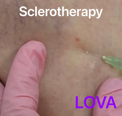 Explore tattoo sleeve ideas women, creative tattoo ideas in Lake Oswego, available at Lake Oswego Vein and Aesthetic LOVA