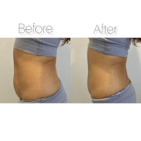 Queen Body Beauty LLC - Photo 4 - Car repair in Chula Vista, CA, Chula Vista