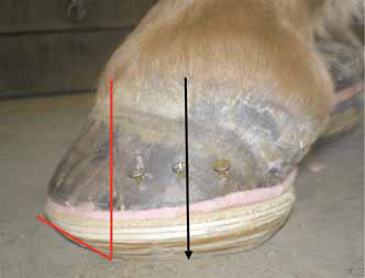 A wooden shoe applied to the foot with impression material. Black arrow is the widest part of the foot. Red line denotes the point of breakover on the ground surface of the shoe. 