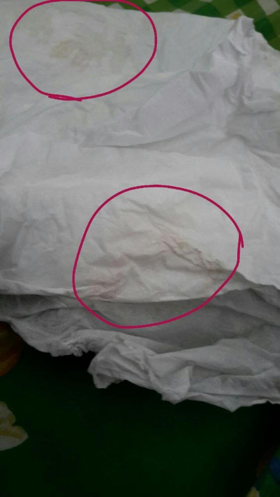 Flek Coklat Tanda Kehamilan Atau Haid Silvy Gambar