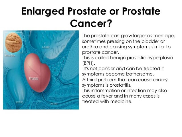 Can an enlarged prostate cause gas
