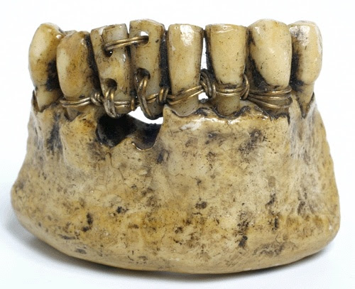Image result for waterloo dentures