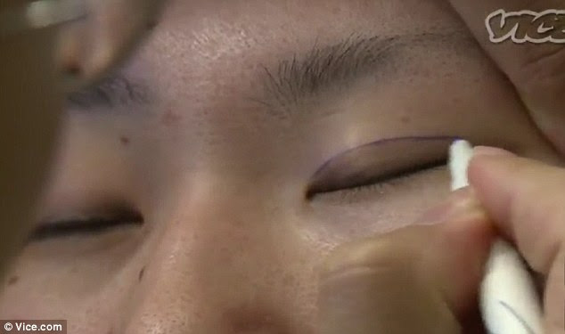 Creating a crease: Eyelid surgery involves cutting the outer end of the eyes to make them wider and rounder, something plastic surgeons say boosts confidence
