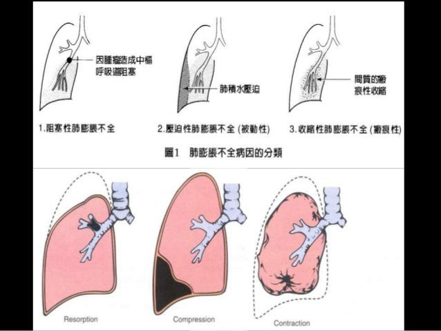 what color ribbon is for thyroid cancer