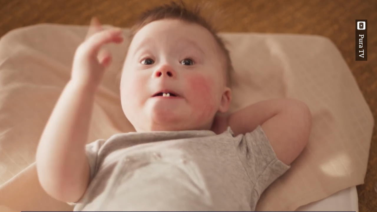 Down Syndrom Baby Bilder / 478 Down S Syndrome Baby Bilder Und Fotos