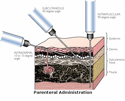 Parenteral Adminitration (1)