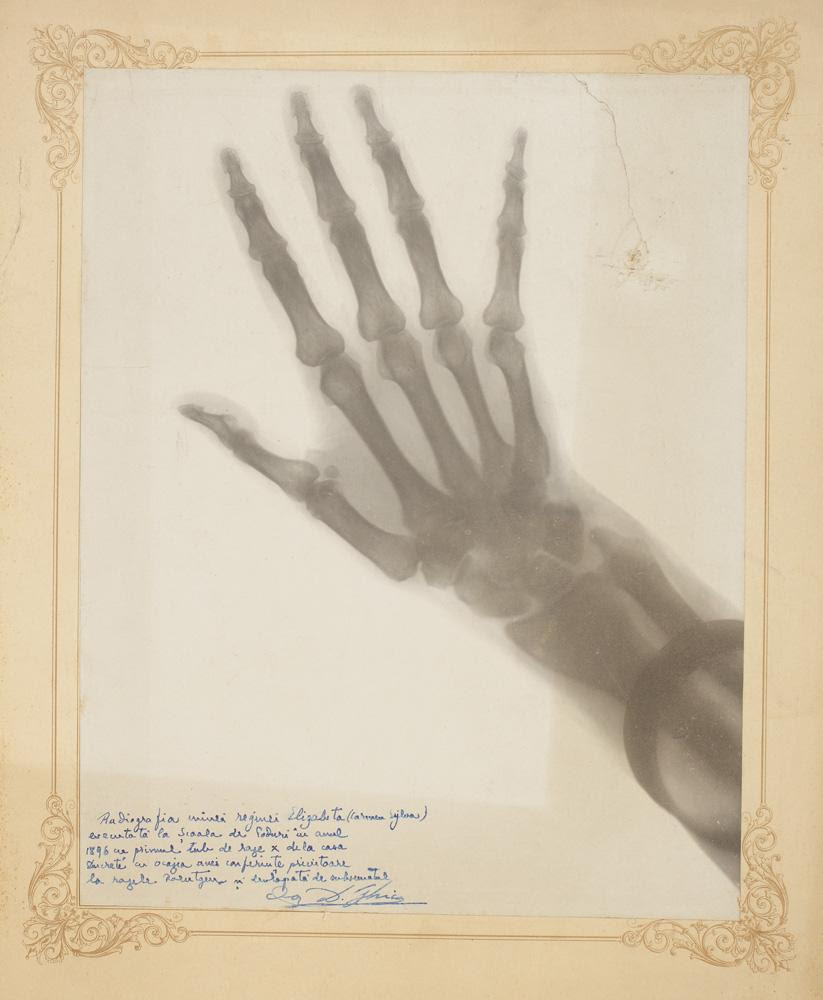 radiografia mâinii drepte a Reginei Elisabeta Queen Marys hand X Ray and trilobite fossil on sale at oddities auction in Bucharest this week 