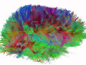 A diffusion spectrum image shows the brain wiring in a healthy human adult. 