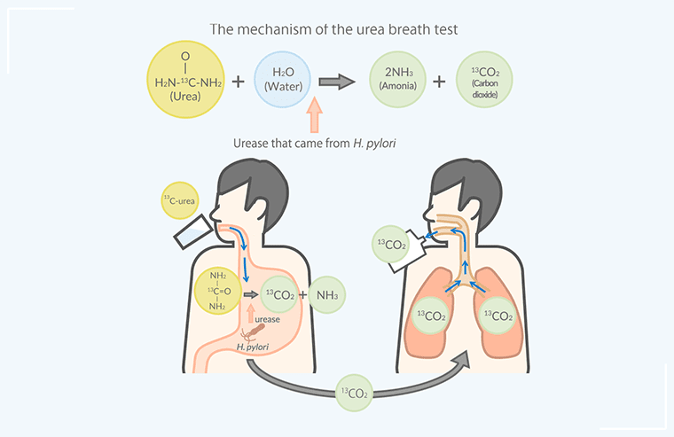Как делается дыхательный тест. 13c-уреазный дыхательный тест. Helicobacter pylori дыхательный тест. Уреазный дыхательный тест на Helicobacter pylori. С13 дыхательный тест на хеликобактер.