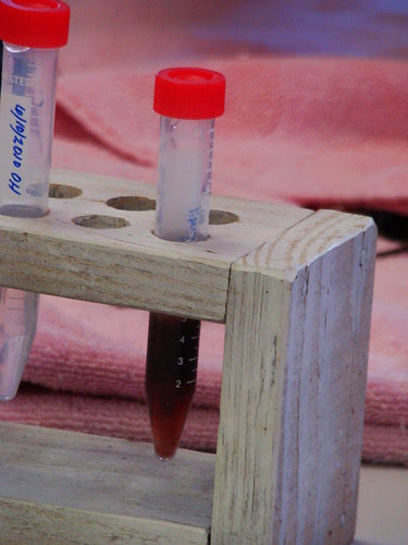 blood sample